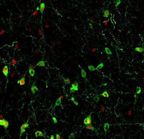 The neurons that connect stress, insomnia, and the immune system