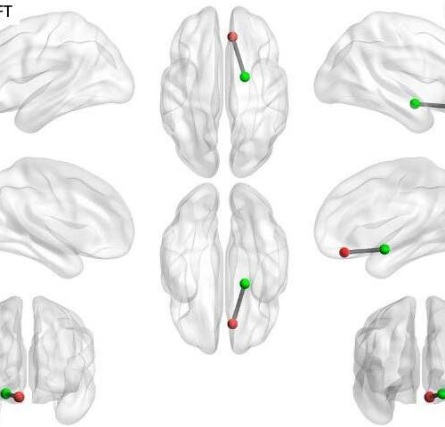 Smartphones can predict brain function associated with anxiety and depression