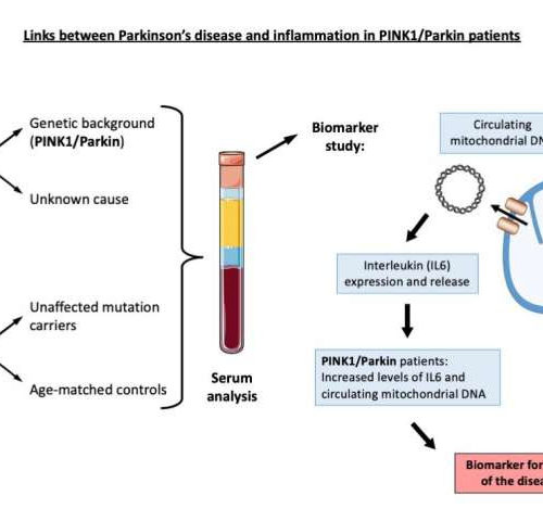 New study highlights links between inflammation and Parkinson’s disease