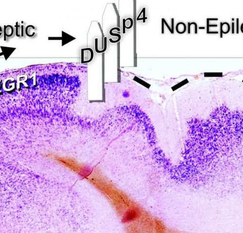 Inhibiting epileptic activity in the brain