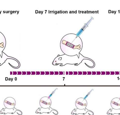 Coupling antibiotics with stem cells to fight off bone infections