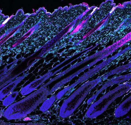 Fine-tuning stem cell metabolism prevents hair loss