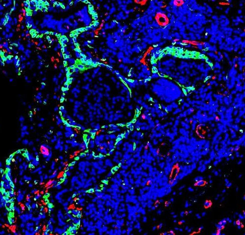 Inhalable Treatment Enhances Lung Regeneration in Lung Fibrosis Model