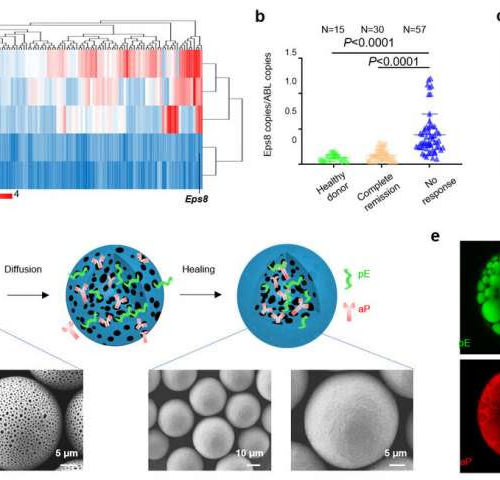 Scientists develop new precise therapeutic leukemia vaccine