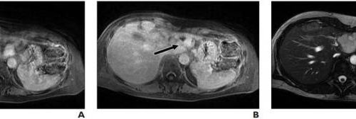 Body MRI reinterpretations plagued by discrepancies and errors