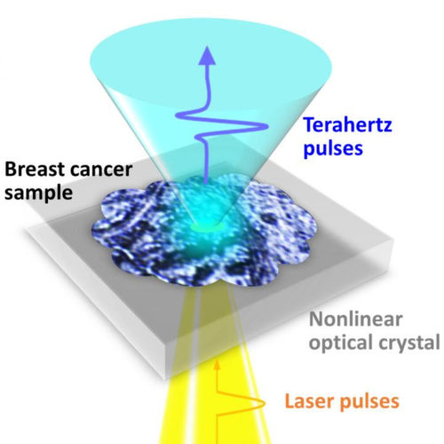 No stain? No sweat: Terahertz waves can image early-stage breast cancer without staining