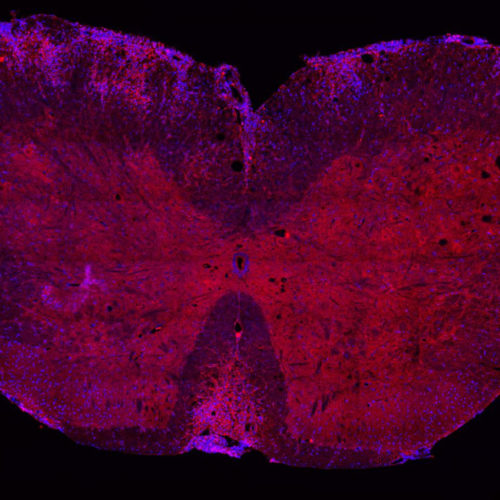 Study identifies key enzyme for development of autoimmune diseases