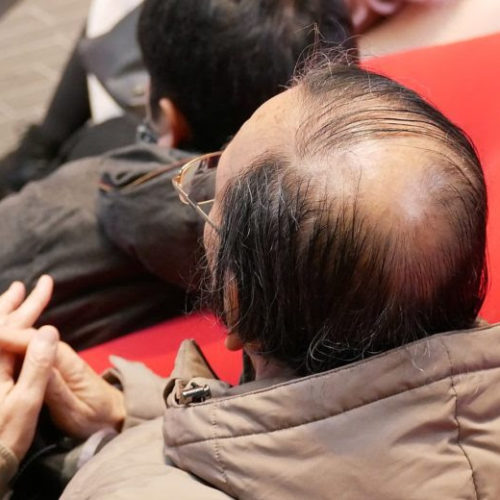 Scientists are getting closer to effective treatment for hair loss