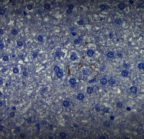 Study shows main cell type in the liver has key role in defending against some viruses