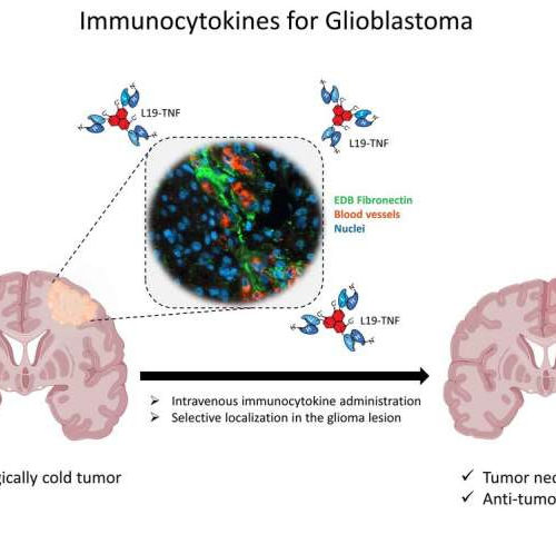 Fusing cytokines with antibodies found to be effective at treating brain tumors in mice