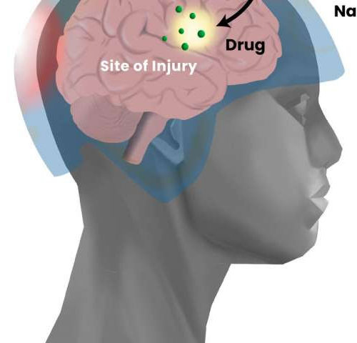 Development of precision drug delivery tool to treat traumatic brain injury