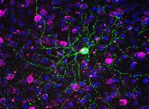 New Interneuron