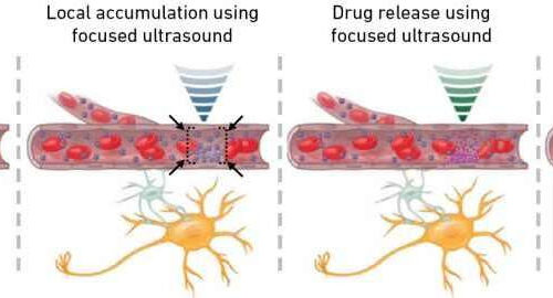 Millimeter-precision drug delivery to the brain