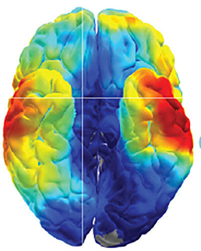 Raised blood pressure and diabetes alter brain structure to slow thinking speed and memory