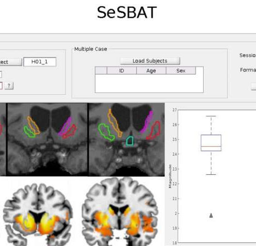 Detecting neurodegeneration biomarkers through magnetic resonance imaging