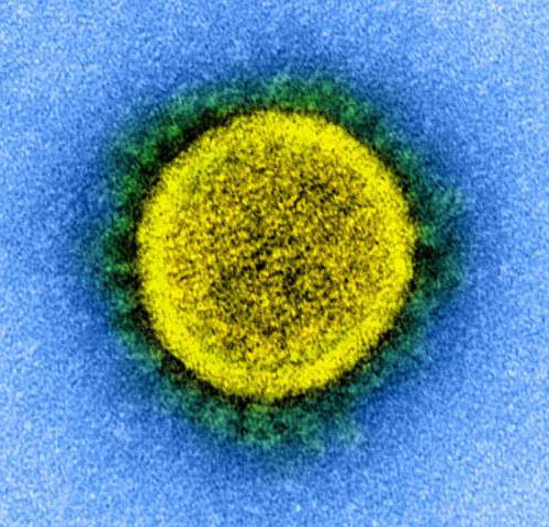 Coronavirus survives on skin five times longer than flu: study