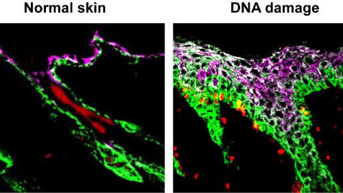 Vanderbilt researchers make counterintuitive discoveries about immune-like characteristics of cells