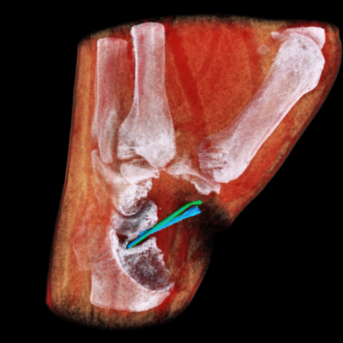 3D color X-ray machine heads for trials