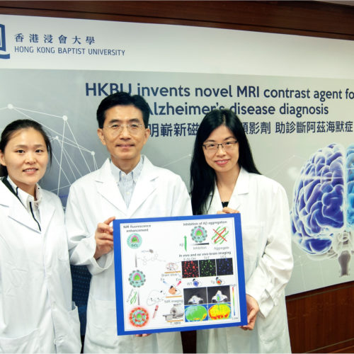 Novel MRI contrast agent offers hope for early detection of Alzheimer’s disease