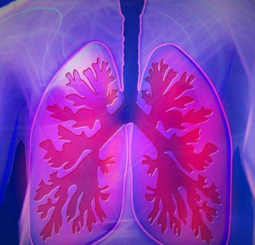 Researchers identify specific genes and cell pathways as key players in rare female lung disease