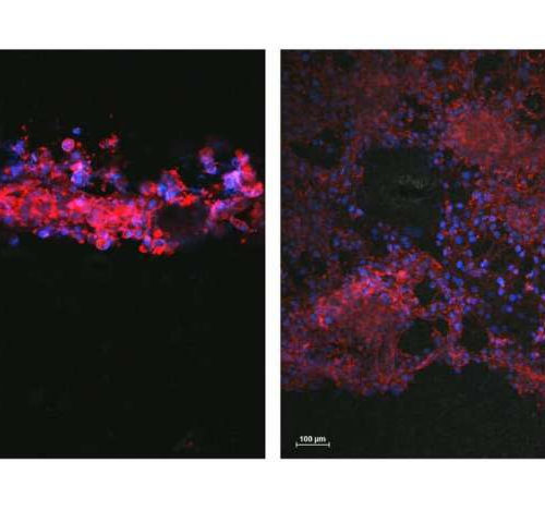 Printable ink guides cell growth, offers nerve injury hope