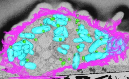 Fats fighting back against bacteria