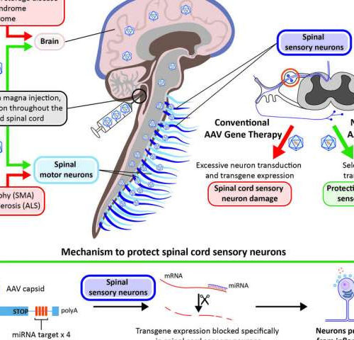 Researchers develop approach to prevent toxicity tied to neurological gene therapy