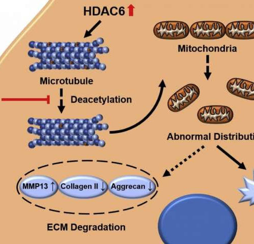 New research reveals potential treatment to delay and manage osteoarthritis