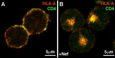 Discovery of protein’s ‘Achilles heel’ paves way for novel class of anti-HIV drugs