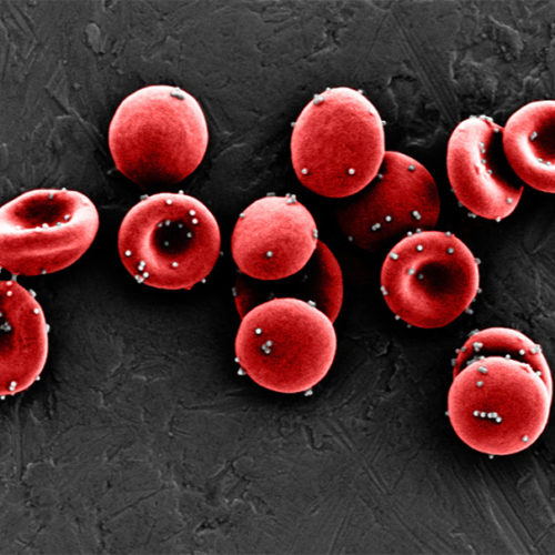 Red Blood Cells Deliver Nanoparticles to Provoke Immune Response to Lung Metastases
