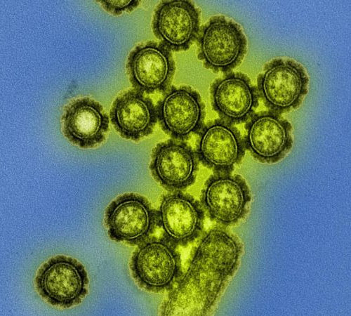 New study explains important cause of fatal influenza