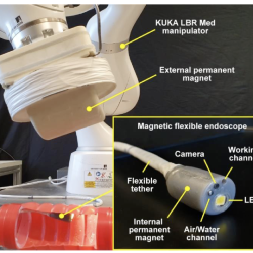 Researchers bring paradigm-shifting technology to endoscopic procedures