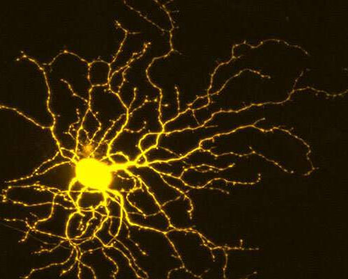 Researchers discover clue to how to protect neurons and encourage their growth