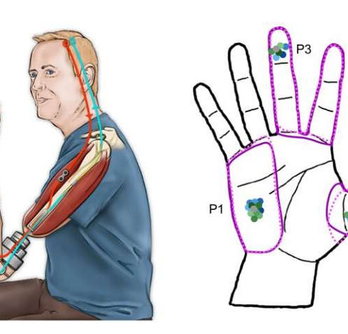 Even after long-term exposure, bionic touch does not remap the brain