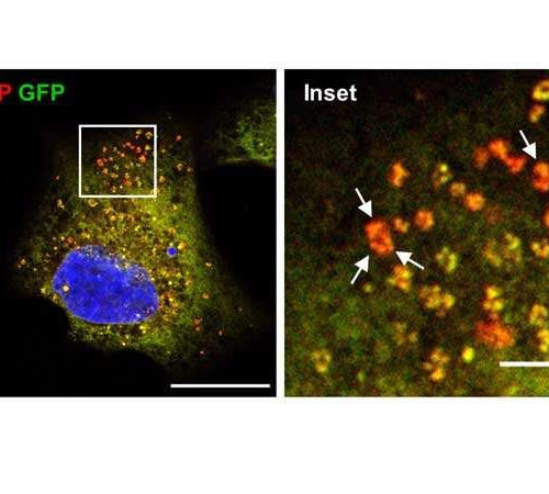 Anti-diarrhea drug drives cancer cells to cell death