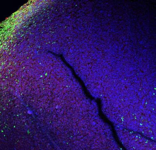 Molecular reporters expose the allies of the brain tumor