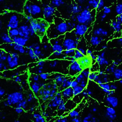 Fear response neurons identified as potential anxiety treatment target