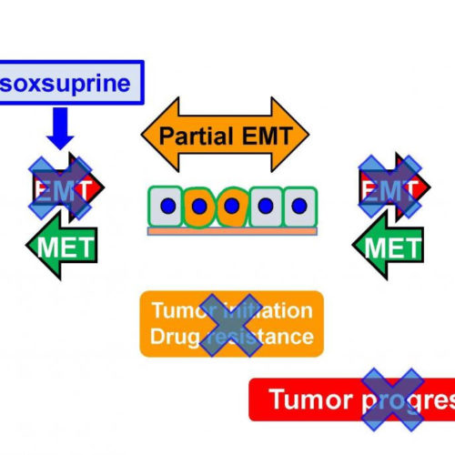 β-AR agonist therapy puts the brakes on oral cancer progression