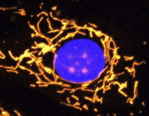 Scientists develop new gene therapy for eye disease