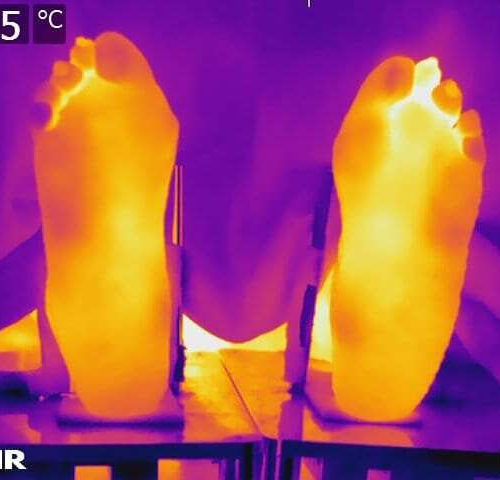 Higher body temperatures still a factor in patients in remission from rheumatoid arthritis