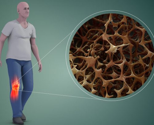 Potential Cellular Target for Eliminating Bone Breakdown in Osteoporosis Found