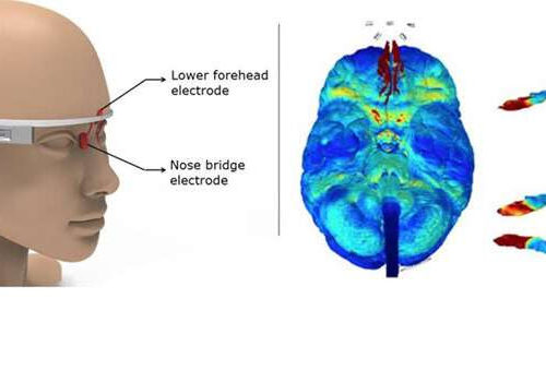 Wearable electrical stimulator to zap Alzheimer’s disease