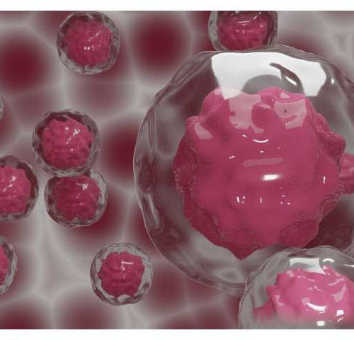 The bull’s eye: New modified stem cells can deliver drugs specifically to tumor cells