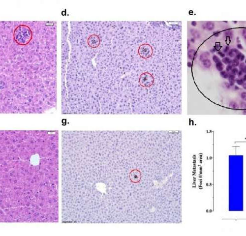 Drug for pulmonary hypertension may become an option against cancer