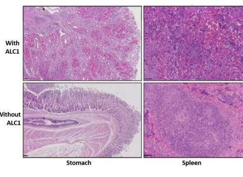 Blocking DNA repair enzyme could help treat certain cancers