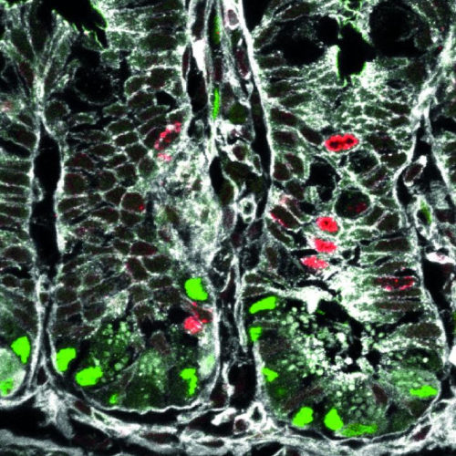 Uncovering basic mechanisms of intestinal stem cell self-renewal and differentiation