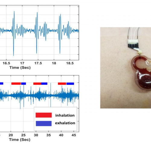 Wearable electronics for continuous cardiac, respiratory monitoring