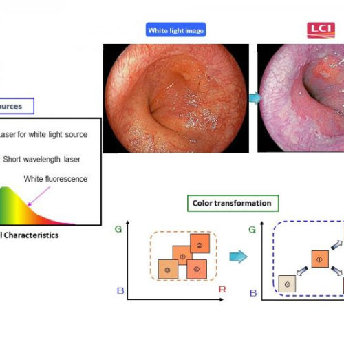 Viewing upper gastrointestinal cancers in a new light