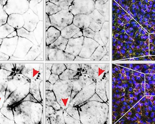 Study: e-cigarettes trigger inflammation in the gut