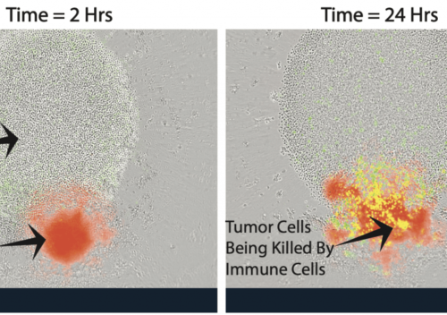 A new way to help the immune system fight back against cancer